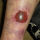 Illustration for article titled How A Softball Almost Killed This Mans Foot